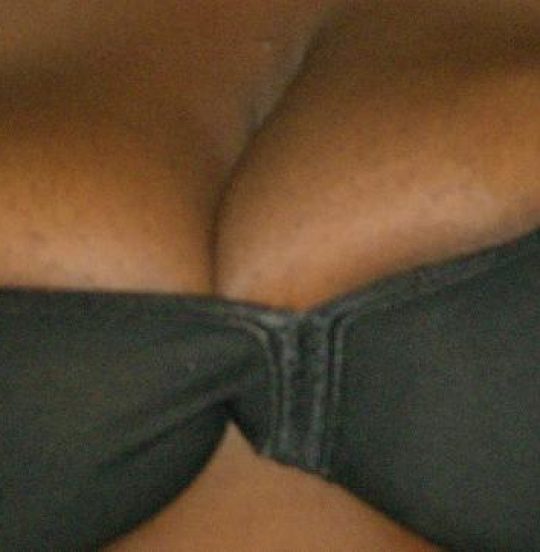 MissBreast